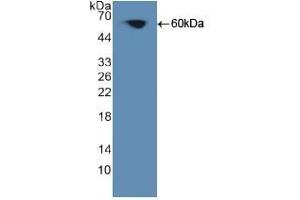 Detection of Recombinant PKCq, Human using Polyclonal Antibody to Protein Kinase C Theta (PKCq) (PKC theta antibody  (AA 380-634))