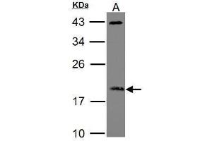 WB Image Sample (30 ug of whole cell lysate) A: Raji 12% SDS PAGE ADP-ribosylation factor 3 antibody antibody diluted at 1:1000 (ARF3 antibody)