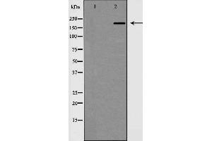 Western blot analysis of MAP2 expression in mouse brain,The lane on the left is treated with the antigen-specific peptide. (MAP2 antibody  (N-Term))