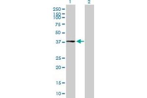 Western Blot analysis of CPXCR1 expression in transfected 293T cell line by CPXCR1 MaxPab polyclonal antibody. (CPXCR1 antibody  (AA 1-301))