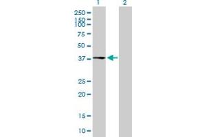CPXCR1 antibody  (AA 1-301)