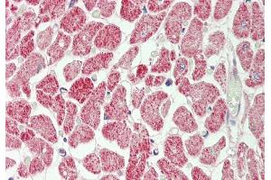 Rabbit Anti-Rps12 antibody Catalog Number: ARP51260 Formalin Fixed Paraffin Embedded Tissue: Human Heart Primary antibody Concentration: 1:100 Secondary Antibody: Donkey anti-Rabbit-Cy3 Secondary Antibody Concentration: 1:200 Magnification: 20x Exposure Time: 0. (RPS12 antibody  (C-Term))