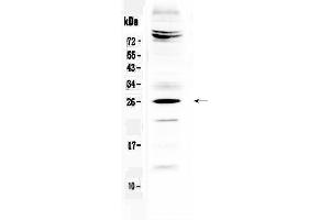 Western blot analysis of SRY using anti-SRY antibody . (SRY antibody  (Middle Region))