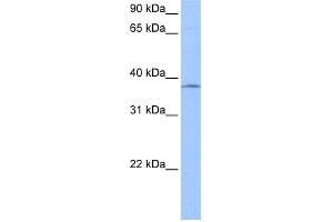 WB Suggested Anti-SPRY2 Antibody Titration:  0. (SPRY2 antibody  (N-Term))