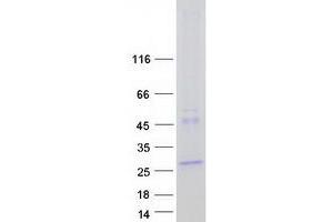 LHFPL2 Protein (Myc-DYKDDDDK Tag)