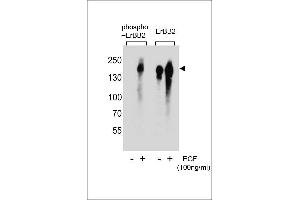 Western blot analysis of extracts from A431 cell,untreated or treated with EGF,using phospho-ERBB2- (left) or ErBB2 Antibody (right). (ErbB2/Her2 antibody  (pTyr1005))