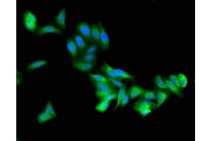 Immunofluorescent analysis of HepG2 cells using ABIN7176655 at dilution of 1:100 and Alexa Fluor 488-congugated AffiniPure Goat Anti-Rabbit IgG(H+L) (ZSWIM6 antibody  (AA 430-583))