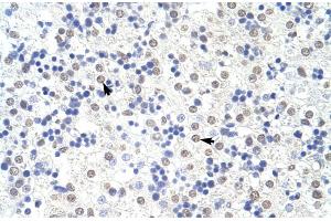 Human Liver (SART3 antibody  (N-Term))
