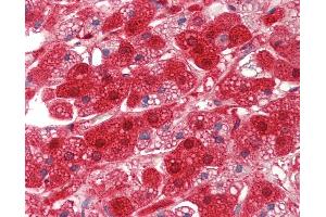 Anti-RDX / Radixin antibody IHC staining of human adrenal. (Radixin antibody  (AA 466-495))
