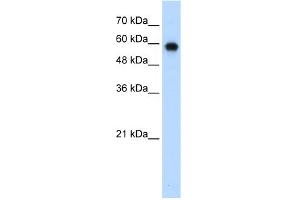 WB Suggested Anti-SMARCD2 Antibody Titration:  0. (SMARCD2 antibody  (C-Term))