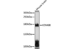 Western blot analysis of extracts of mouse brain, using KDM6B antibody (ABIN6131823, ABIN6142806, ABIN6142809 and ABIN6216507) at 1:1000 dilution. (Kdm6b antibody  (AA 265-450))