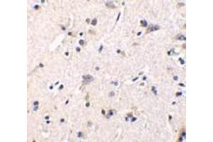 Immunohistochemistry of GFR alpha 1 in human brain tissue with GFR alpha 1 antibody at 1 μg/ml. (GFRA1 antibody  (Intermediate Domain))