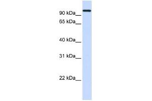 HSPA4 antibody used at 1 ug/ml to detect target protein.