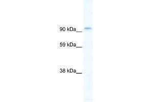 WB Suggested Anti-PIK3CB Antibody Titration:  5ug/ml  Positive Control:  Human brain (PIK3CB antibody  (C-Term))