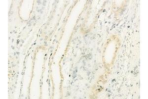 ABIN6260934 and ABIN6273212 at 1/100 staining human normal kidney tissue by IHC-P. (COLEC11 antibody  (C-Term))