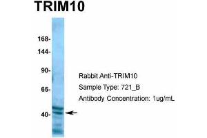 Human 721_B; Host: Rabbit. (TRIM10 antibody  (C-Term))