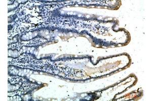 Immunohistochemical analysis of paraffin-embedded human-colon, antibody was diluted at 1:200 (Selectin E/CD62e antibody)