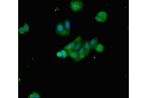 Immunofluorescent analysis of HepG2 cells using ABIN7145302 at dilution of 1:100 and Alexa Fluor 488-congugated AffiniPure Goat Anti-Rabbit IgG(H+L) (BIM antibody  (AA 1-198))
