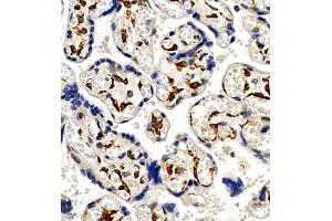 Immunohistochemistry of paraffin embedded human placenta using CCRL2 (ABIN7073461) at dilution of 1:300 (400x lens)