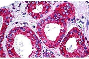 Human Prostate: Formalin-Fixed, Paraffin-Embedded (FFPE) (TRAF3IP2 antibody  (AA 451-566))