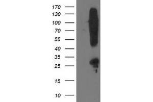 HEK293T cells were transfected with the pCMV6-ENTRY control (Left lane) or pCMV6-ENTRY SNAP25 (Right lane) cDNA for 48 hrs and lysed. (SNAP25 antibody)