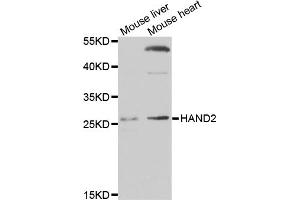 Western blot analysis of extracts of various cell lines, using HAND2 antibody.