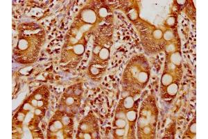 IHC image of nphHU diluted at 1:8 and staining in paraffin-embedded human small intestine tissue performed on a Leica BondTM system. (Histone H1.5 antibody  (AA 14-25))