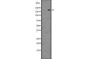 Western blot analysis of PARP4 expression in Hela cell lysate,The lane on the left is treated with the antigen-specific peptide. (PARP4 antibody  (Internal Region))