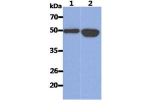 The Recombinant Human KRT14 (50ng) and Cell lysates (40ug) were resolved by SDS-PAGE, transferred to PVDF membrane and probed with anti-human KRT14 antibody (1:1000). (KRT14 antibody  (AA 1-472))
