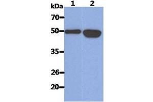 The Recombinant Human KRT14 (50ng) and Cell lysates (40ug) were resolved by SDS-PAGE, transferred to PVDF membrane and probed with anti-human KRT14 antibody (1:1000).