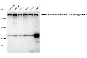 Western blotting analysis using Chromodomain helicase DNA binding protein 4 antibody (ABIN7800918). (Recombinant Chromodomain Helicase DNA Binding 4 antibody)