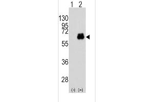 Western blot analysis of MYC (arrow) using rabbit polyclonal MYC Antibody (T58) (ABIN388723 and ABIN2838831). (c-MYC antibody  (AA 36-65))