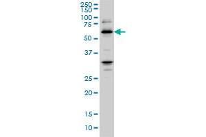 RBBP4 monoclonal antibody (M02), clone 4A5 Western Blot analysis of RBBP4 expression in Hela S3 NE . (Retinoblastoma Binding Protein 4 antibody  (AA 316-426))