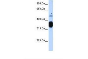 Image no. 1 for anti-Fast Skeletal Troponin T (TNNT3) (AA 31-80) antibody (ABIN321848) (TNNT3 antibody  (AA 31-80))