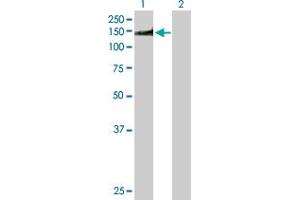 Western Blot analysis of NUMA1 expression in transfected 293T cell line by NUMA1 MaxPab polyclonal antibody. (NUMA1 antibody  (AA 1-1193))