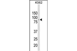 Western blot analysis of ALDH18A1 Antibody in K562 cell line lysates (35ug/lane) (P5CS antibody  (AA 176-205))
