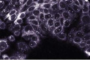 HCT-8 (PTPN1 antibody  (AA 269-435))