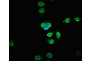 Immunofluorescence staining of A549 cells with ABIN7165136 at 1:133, counter-stained with DAPI. (BICC1 antibody  (AA 682-849))