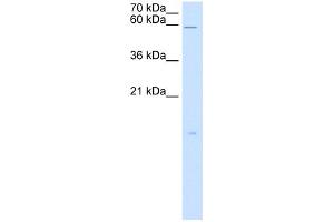 WB Suggested Anti-RARRES3 Antibody Titration:  5. (RARRES3 antibody  (Middle Region))