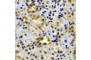 Immunohistochemical analysis of EPHX2 staining in rat kidney formalin fixed paraffin embedded tissue section. (EPHX2 antibody)