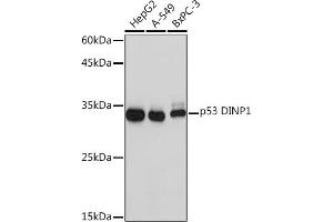 Western blot analysis of extracts of various cell lines, using p53 DINP1 Rabbit mAb (ABIN7271097) at 1:1000 dilution. (TP53INP1 antibody)
