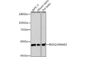 Western blot analysis of extracts of various cell lines, using RIOX2/RIOX2/MIN Rabbit mAb (ABIN7269991) at 1:1000 dilution. (RIOX2 antibody)