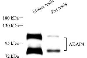 Western blot analysis of AKAP4 (ABIN7072868),at dilution of 1: 1000