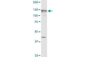 MSH6 monoclonal antibody (M01), clone 1F2. (MSH6 antibody  (AA 931-1030))