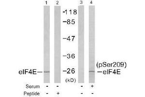Image no. 2 for anti-Eukaryotic Translation Initiation Factor 4E (EIF4E) (pSer209) antibody (ABIN196984) (EIF4E antibody  (pSer209))