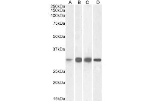 ABIN5539547 (0. (Ketohexokinase antibody  (Internal Region))