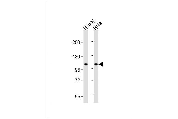 NAT10 抗体  (AA 146-178)
