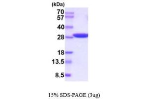 SDS-PAGE (SDS) image for Triosephosphate Isomerase 1 (TPI1) (AA 1-249) (Active) protein (His tag) (ABIN6387938)