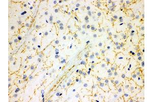 Anti- SLC6A4 Picoband antibody, IHC(P) IHC(P): Rat Brain Tissue (SLC6A4 antibody  (N-Term))