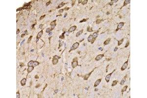 Immunohistochemistry of paraffin-embedded Mouse brain using RPS14 Polyclonal Antibody at dilution of 1:100 (40x lens).